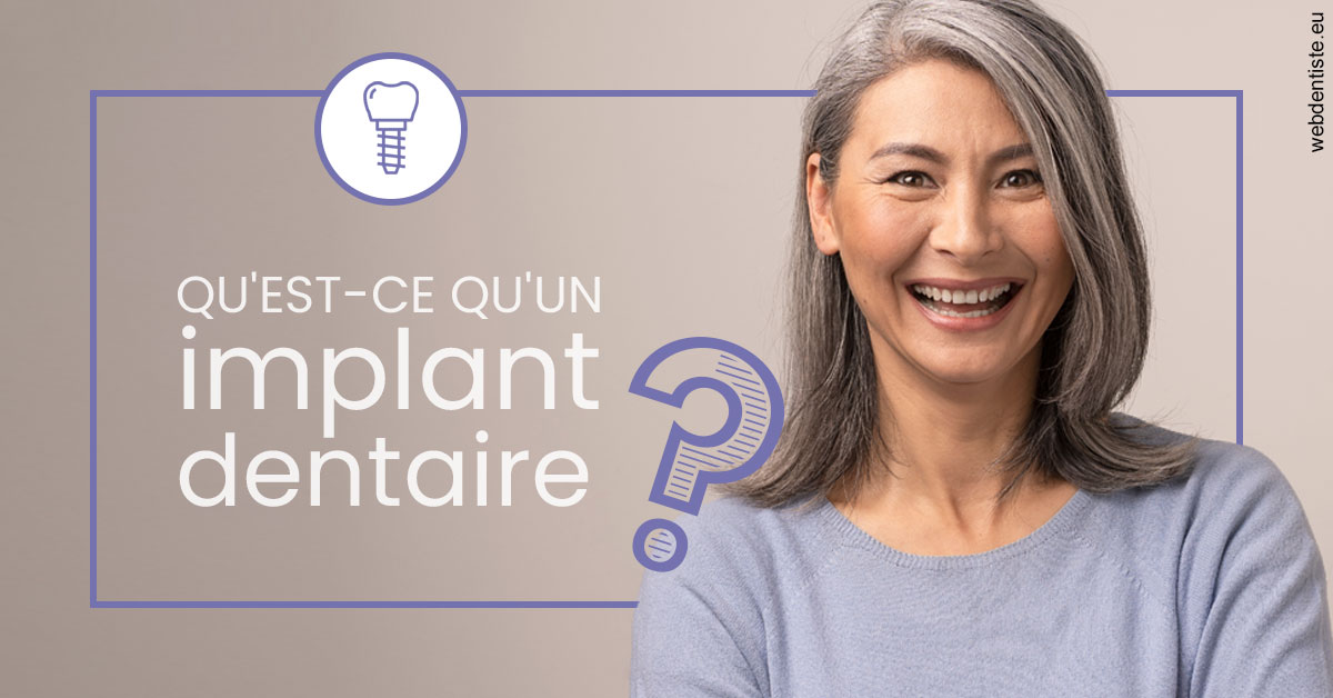 https://dr-tapiero-steeve.chirurgiens-dentistes.fr/Implant dentaire 1