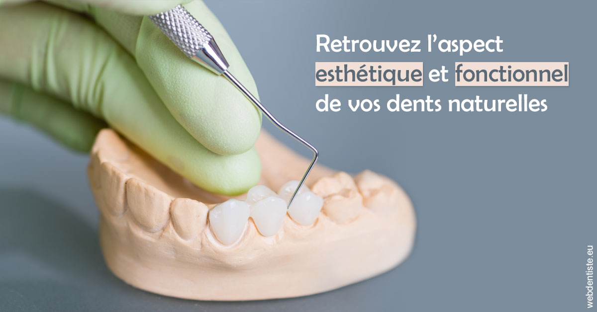 https://dr-tapiero-steeve.chirurgiens-dentistes.fr/Restaurations dentaires 1