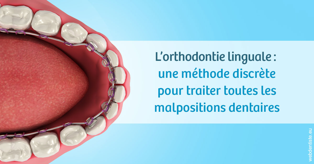 https://dr-tapiero-steeve.chirurgiens-dentistes.fr/L'orthodontie linguale 1