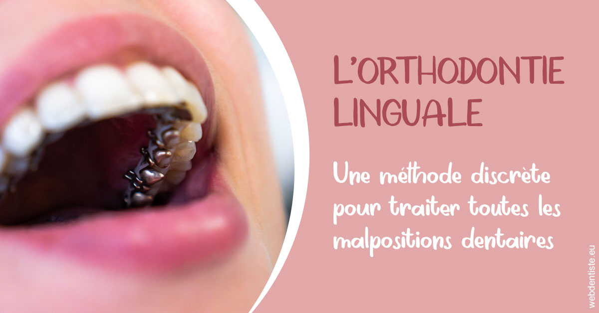 https://dr-tapiero-steeve.chirurgiens-dentistes.fr/L'orthodontie linguale 2