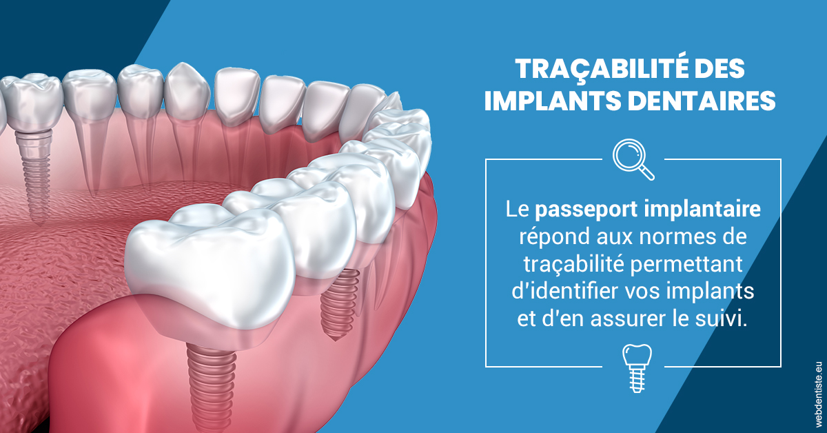 https://dr-tapiero-steeve.chirurgiens-dentistes.fr/T2 2023 - Traçabilité des implants 1